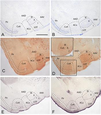 Afferent and Efferent Connections of the Cortex-Amygdala Transition Zone in Mice